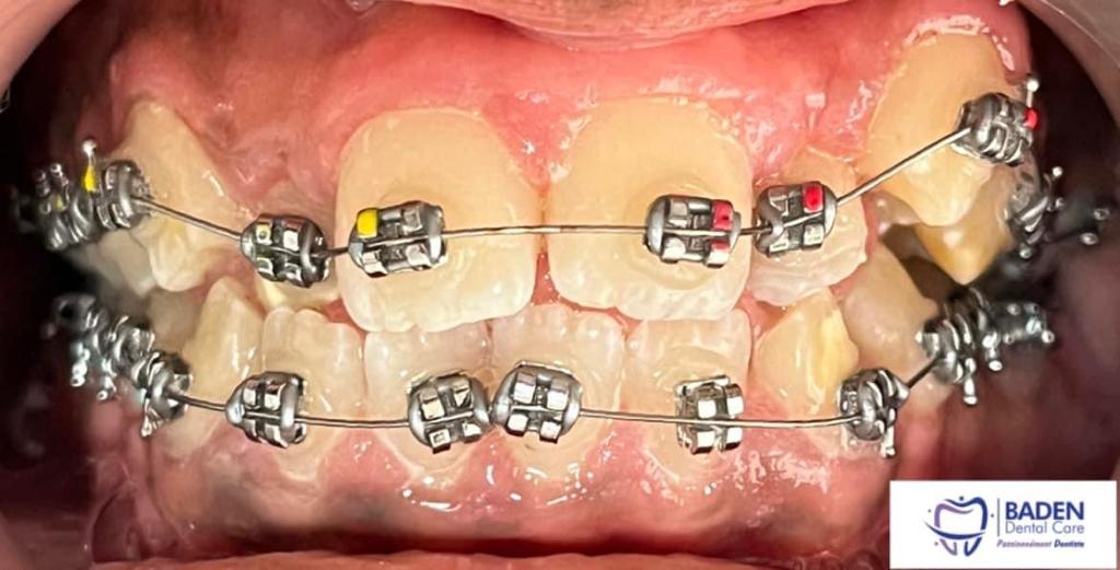 Orthodontie