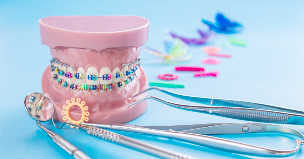 Fiche d’Information sur l’Orthodontie